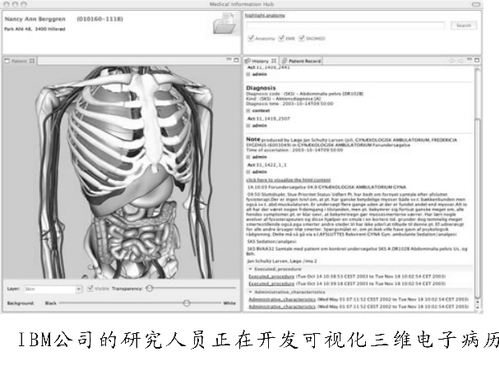 IBM公司的研究人员正在开发可视化三维电子病历