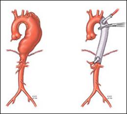 http://www.scientificamerican.com/sciam/cache/file/21BE5981-3809-4E08-9FE2473D4F31B84E_article.jpg?15952